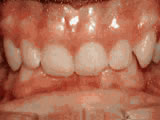 Common Orthodontic Issues web image