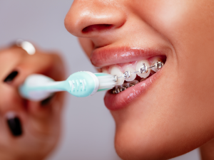 Tips for Braces Care and Hygiene braces web image