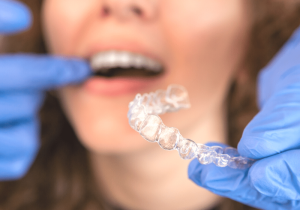 How to Insert & Remove Your Invisalign insert web image